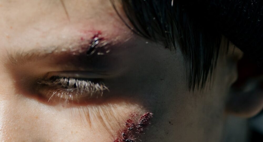 odszkodowanie za uraz twarzy